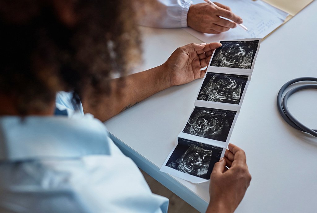 An over-the-shoulder shot of a Black woman looking at her fetal ultrasound images, as part of her obstetrical prenatal monitoring.
