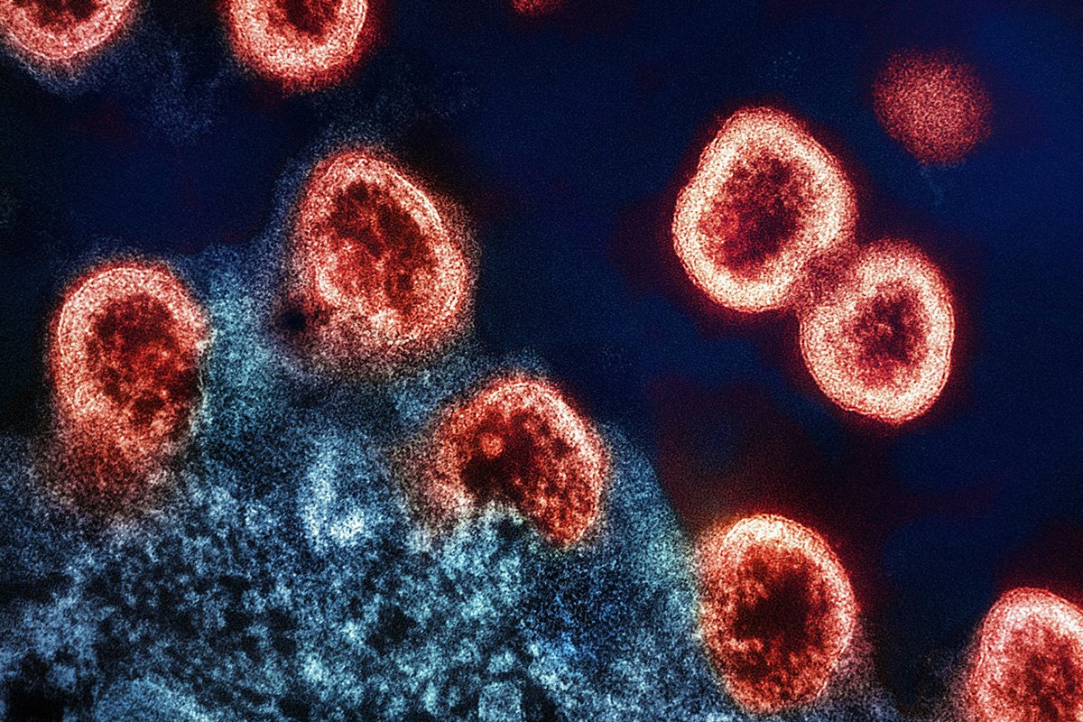 An electron micrograph of HIV-1 virus particles, spiky balls colorized red, replicating from an infected T-cell, a blob colorized blue. Image captured at the NIAID Integrated Research Facility (IRF) in Fort Detrick, Maryland.
